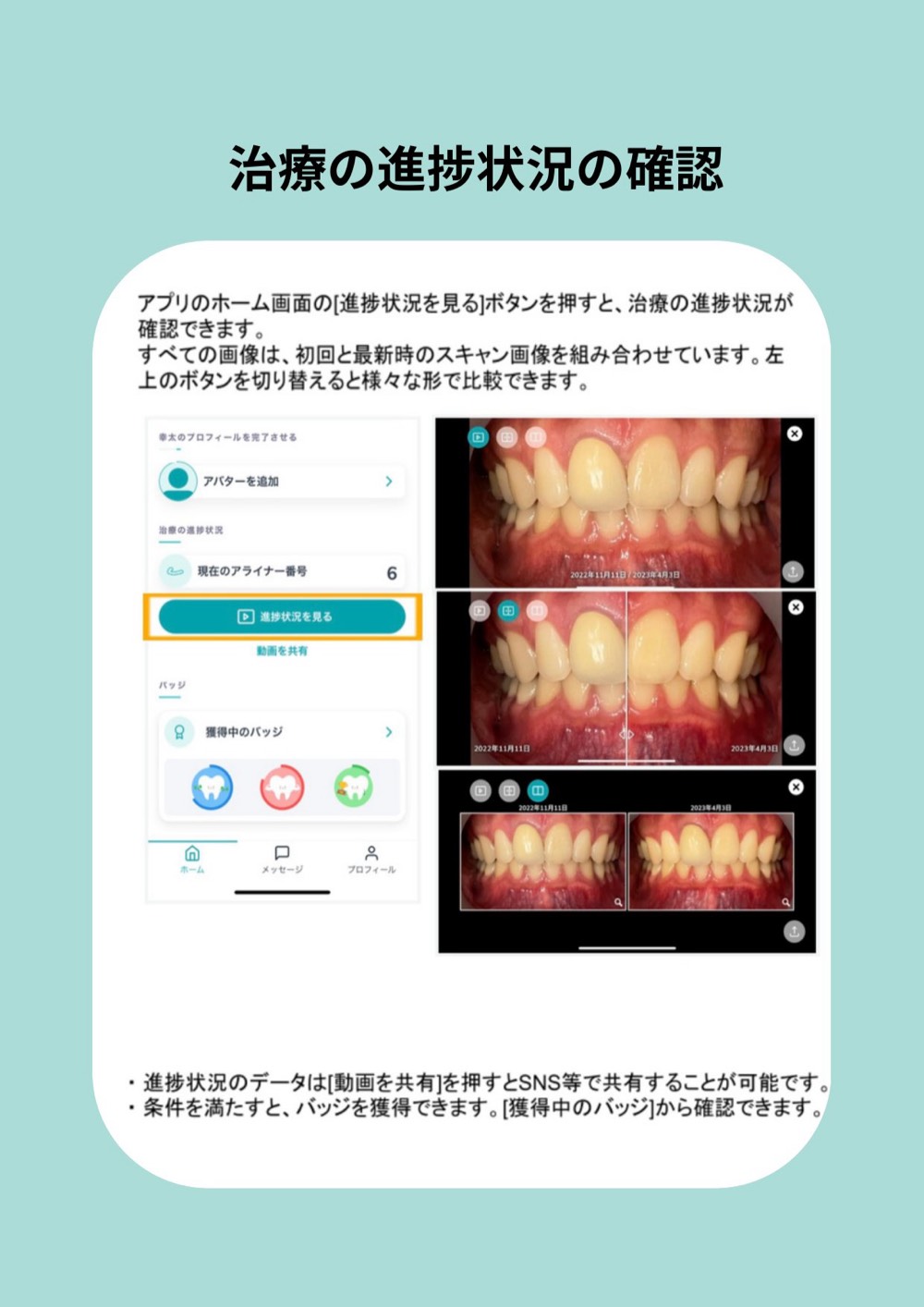 治療の進捗状況の確認画面
